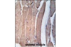 Formalin-fixed and paraffin-embedded human skeletal muscle tissue reacted with DK2 Antibody (N-term V55) 7218a , which was peroxidase-conjugated to the secondary antibody, followed by DAB staining. (DAPK2 Antikörper  (N-Term))