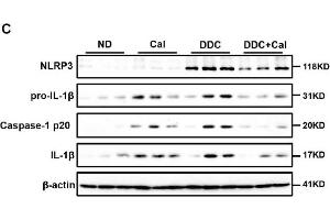 Calcipotriol supplement inhibits the NLRP3 inflammasome activation during DDC-induced and BDL-induced cholestatic liver injury. (NLRP3 Antikörper  (C-Term))