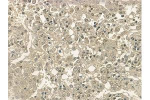 ABIN6255875 and ABIN6267214 at 1/100 staining human normal lung tissue by IHC-P. (CDK6 Antikörper  (pTyr292))