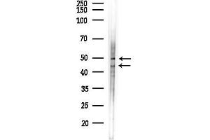 anti-Ataxin 2-Binding Protein 1 (A2BP1) (N-Term) antibody