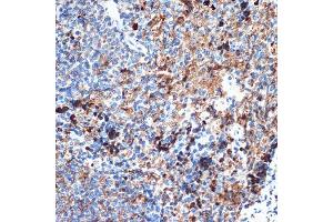 Immunohistochemistry of paraffin-embedded rat spleen using CRMP5/DPYSL5 Rabbit mAb (ABIN7266774) at dilution of 1:100 (40x lens).