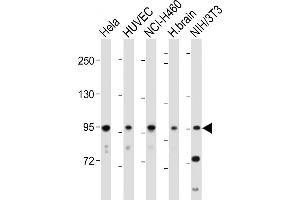 All lanes : Anti-EphA4 Antibody (C-term) at 1:2000 dilution Lane 1: Hela whole cell lysate Lane 2: HUVEC whole cell lysate Lane 3: NCI- whole cell lysate Lane 4: Human brain tissue lysate Lane 5: NIH/3T3 whole cell lysate Lysates/proteins at 20 μg per lane. (EPH Receptor A4 Antikörper  (C-Term))