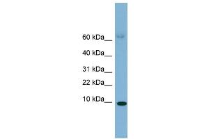 WB Suggested Anti-SAA4 Antibody Titration:  0.