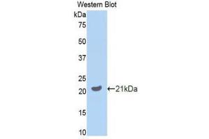 Western Blotting (WB) image for anti-Growth Arrest-Specific 6 (GAS6) (AA 483-646) antibody (ABIN1858961) (GAS6 Antikörper  (AA 483-646))