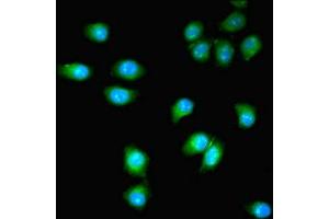 Immunofluorescent analysis of A549 cells using ABIN7163630 at dilution of 1:100 and Alexa Fluor 488-congugated AffiniPure Goat Anti-Rabbit IgG(H+L) (PDGFRB Antikörper  (AA 901-1106))