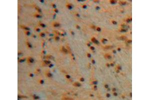 Used in DAB staining on fromalin fixed paraffin-embedded Brain tissue (Erythrocyte Ankyrin Antikörper  (AA 32-369))