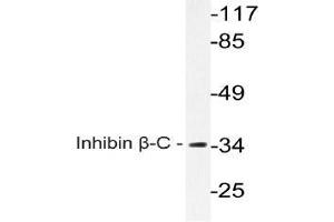 Western blot (WB) analysis of Inhibin beta-C antibody in extracts from A549 cells.