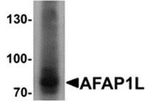 Western blot analysis of AFAP1L1 in A549 cell lysate with AFAP1L1 Cat. (AFAP1L1 Antikörper  (N-Term))