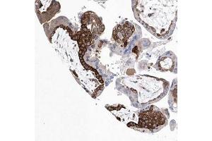 Immunohistochemical staining of human placenta with C14orf100 polyclonal antibody ( Cat # PAB28315 ) shows strong cytoplasmic positivity in trophoblastic cells. (JKAMP Antikörper)