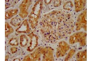 Immunohistochemistry (IHC) image for anti-Cholinergic Receptor, Nicotinic, beta 2 (Neuronal) (CHRNB2) (AA 322-458) antibody (ABIN7161352)