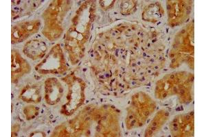 IHC image of ABIN7161352 diluted at 1:400 and staining in paraffin-embedded human kidney tissue performed on a Leica BondTM system. (CHRNB2 Antikörper  (AA 322-458))