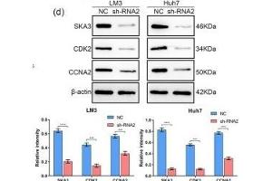 Downregulation of SKA3 affects the cell cycle in HCC cells. (SKA3 Antikörper  (AA 201-300))