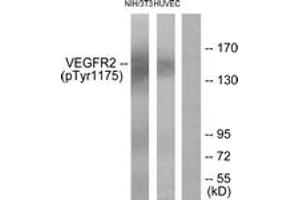 Western blot analysis of extracts from HuvEc cells and NIH/3T3 cells, using VEGFR2 (Phospho-Tyr1175) Antibody. (VEGFR2/CD309 Antikörper  (pTyr1175))
