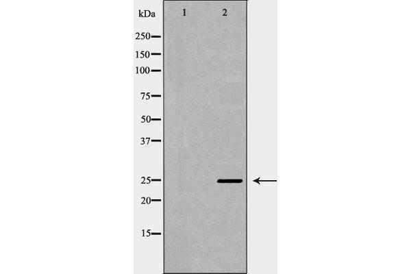 SOCS3 Antikörper  (C-Term)