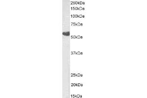 ABIN4902780 (0. (TBXA2R Antikörper  (Isoform beta))