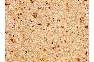 IHC image of ABIN7158074 diluted at 1:100 and staining in paraffin-embedded human brain tissue performed on a Leica BondTM system. (LGI2 Antikörper  (AA 194-310))