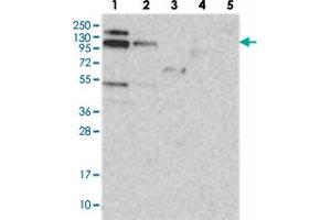 Western blot analysis of Lane 1: RT-4, Lane 2: U-251 MG, Lane 3: Human Plasma, Lane 4: Liver, Lane 5: Tonsil with RBM15B polyclonal antibody  at 1:250-1:500 dilution. (RBM15B Antikörper)