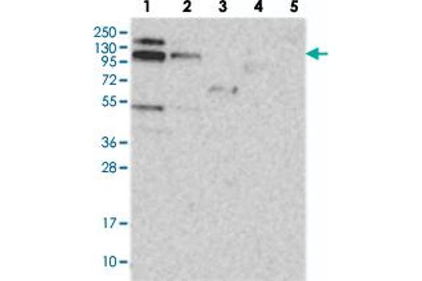 RBM15B Antikörper