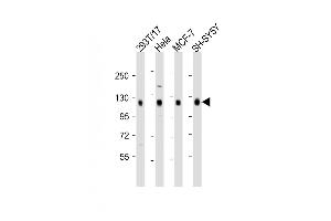 All lanes : Anti-DLG1 Antibody (Center) at 1:2000 dilution Lane 1: 293T/17 whole cell lysate Lane 2: Hela whole cell lysate Lane 3: MCF-7 whole cell lysate Lane 4: SH-SY5Y whole cell lysate Lysates/proteins at 20 μg per lane. (DLG1 Antikörper  (AA 643-673))