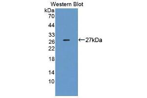Western blot analysis of the recombinant protein. (DNAJC2 Antikörper  (AA 442-621))