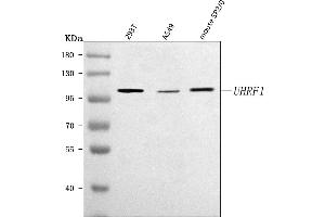 Western blot analysis of UHRF1 using anti-UHRF1 antibody (ABIN7602109).
