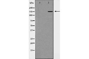 Western blot analysis of Hela cell lysate, using WHSC1L1 Antibody.