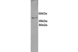 anti-Aurora Kinase (C-Term) antibody