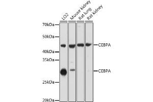 Western blot analysis of extracts of various cell lines, using CEBPA antibody ( ABIN6131380, ABIN6138380, ABIN6138381 and ABIN6214018) at 1:1000 dilution. (CEBPA Antikörper  (AA 1-205))
