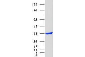 Western Blotting (WB) image for 5'-Nucleotidase, Cytosolic III (NT5C3) (Transcript Variant 3) protein (Myc-DYKDDDDK Tag) (ABIN2727660)