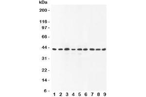 Western blot testing of SOX7 antibody and Lane 1:  rat brain;  2: human placenta;  3: (r) lung;  4: (r) testis;  5: (h) HeLa;  6: (h) A549;  7: (h) HEPG2;  8: (h) SMMC-7721;  9: mouse Neuro-2a lysate (SOX7 Antikörper  (C-Term))