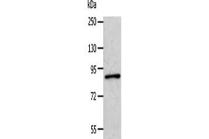 Western Blotting (WB) image for anti-Adaptor Protein, phosphotyrosine Interaction, PH Domain and Leucine Zipper Containing 1 (APPL1) antibody (ABIN2421250) (APPL1 Antikörper)