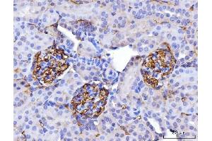 IHC analysis of CD147/Emmprin using anti-CD147/Emmprin antibody (ABIN7599997). (CD147 Antikörper  (AA 138-323))