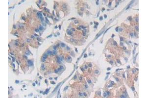 IHC-P analysis of Human Stomach Tissue, with DAB staining. (SYNE1 Antikörper  (AA 30-283))