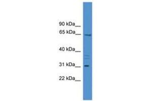 Image no. 1 for anti-Matrix Extracellular phosphoglycoprotein (MEPE) (AA 350-399) antibody (ABIN6745445)