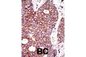 Immunohistochemistry (Paraffin-embedded Sections) (IHC (p)) image for anti-Glucosaminyl (N-Acetyl) Transferase 1, Core 2 (GCNT1) (AA 399-428), (C-Term) antibody (ABIN389034)