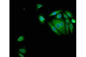 Immunofluorescence staining of A549 cells with ABIN7169337 at 1:150, counter-stained with DAPI. (SERPINB3 Antikörper  (AA 2-383))