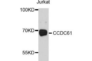 Western blot analysis of extracts of Jurkat cells, using CCDC61 antibody (ABIN5997378) at 1/1000 dilution. (CCDC61 Antikörper)