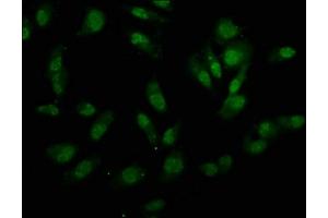 Immunofluorescence staining of Hela cells with ABIN7155342 at 1:133, counter-stained with DAPI. (UTY Antikörper  (AA 1-72))