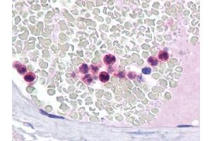 Immunohistochemistry (IHC) image for anti-Interferon Regulatory Factor 4 (IRF4) (AA 342-452) antibody (ABIN614626)