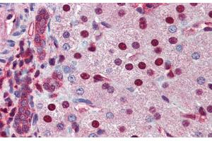 Immunohistochemistry (IHC) image for anti-Nuclear Receptor Subfamily 0, Group B, Member 2 (NR0B2) (Middle Region) antibody (ABIN2782296)