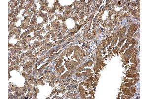 IHC-P Image Dishevelled 3 antibody [N1N2], N-term detects Dishevelled 3 protein at cytoplasm on mouse lung by immunohistochemical analysis. (DVL3 Antikörper  (N-Term))