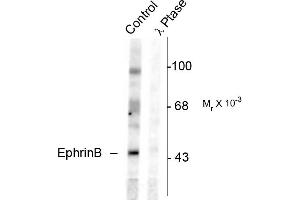 Western blots of rat testes lysate showing specific immunolabeling of the ~46k EphrinB phosphorylated at Tyr331 (Control). (EPH Receptor B2 Antikörper  (pTyr331))