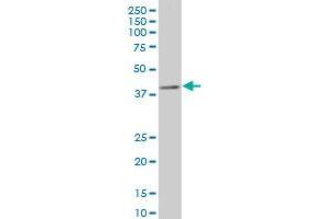 anti-Caudal Type Homeobox 4 (CDX4) (AA 202-284) antibody