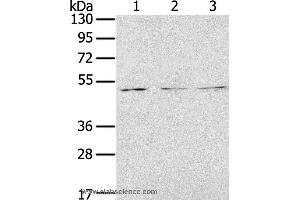 Western blot analysis of Jurkat, K562 and 293T cell, using FOXG1  Polyclonal Antibody at dilution of 1:200 (FOXG1 Antikörper)