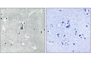 Immunohistochemistry analysis of paraffin-embedded human brain, using Bax (Phospho-Ser184) Antibody. (BAX Antikörper  (pSer184))