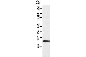 Gel: 12 % SDS-PAGE, Lysate: 40 μg, Lane: Human placenta tissue, Primary antibody: ABIN7130526(PAGE1 Antibody) at dilution 1/200, Secondary antibody: Goat anti rabbit IgG at 1/8000 dilution, Exposure time: 3 minutes (PAGE1 Antikörper)