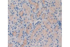 Immunohistochemistry (IHC) image for anti-Low Density Lipoprotein Receptor-Related Protein Associated Protein 1 (LRPAP1) (AA 241-358) antibody (ABIN1859712)