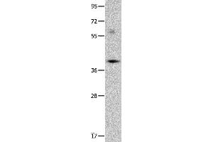 Western blot analysis of Mouse brain tissue, using OPCML Polyclonal Antibody at dilution of 1:400