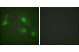 Immunofluorescence analysis of HeLa cells treated with EGF 200nM 5', using NF-kappaB p105/p50 (Phospho-Ser927) Antibody. (NFKB1 Antikörper  (pSer927))