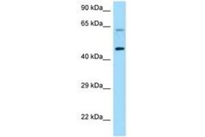 Image no. 1 for anti-Corticotropin Releasing Hormone Receptor 1 (CRHR1) (AA 263-312) antibody (ABIN6748193) (CRHR1 Antikörper  (AA 263-312))